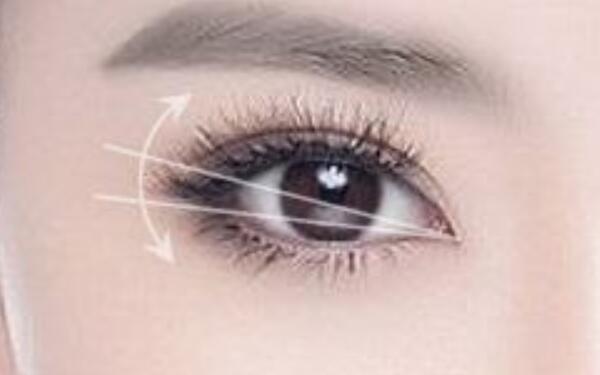 上海哪家醫(yī)院提供專業(yè)光纖溶脂祛魚尾紋服務？2023最新排名揭曉！