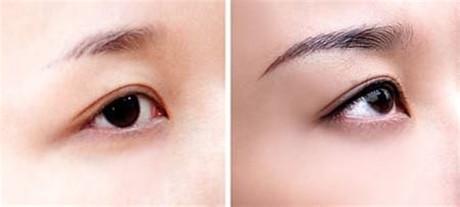 廣州吸脂瘦大臂整形醫(yī)院盤點(diǎn)！2023年強(qiáng)力推薦前10家！