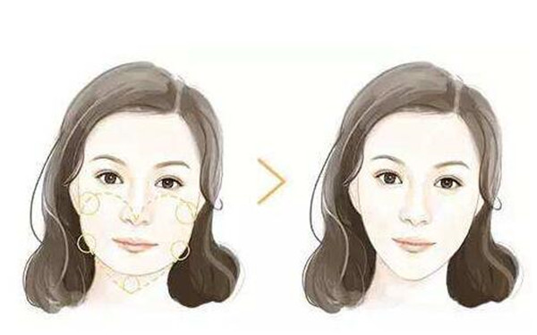 南京哪家整形醫(yī)院能有效去除面部皺紋？2023年南京治療面部皺紋醫(yī)院排名前10強！