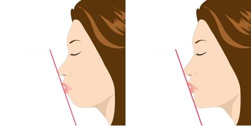 2023鄭州哪家口碑不錯(cuò)的切開(kāi)填充去痘疤整形美容醫(yī)院排行榜發(fā)布，前10強(qiáng)揭曉！