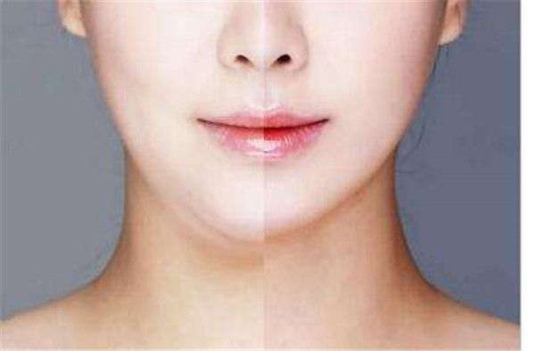 南京哪里可以做眉間紋注射填充手術(shù)？2023年南京眉間紋注射填充醫(yī)院實(shí)力排行榜發(fā)布！前十家醫(yī)療整形機(jī)構(gòu)評(píng)測(cè)