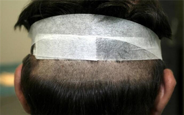 重慶哪家醫(yī)院豐唇口碑好？2023年榜單前十大整形美容醫(yī)院推薦！