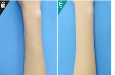 2023年西安陰道緊縮術修補醫(yī)院推薦TOP10強熱門評分揭曉！