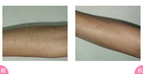 2023蘇州祛頸紋哪家醫(yī)院好？口碑比較好的10所整形醫(yī)院更新！