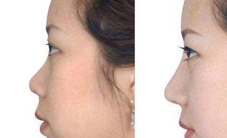 太原哪家醫(yī)院專業(yè)斑點(diǎn)祛老，口碑比較好？2023太原斑點(diǎn)祛老美容醫(yī)院排名TOP10熱門(mén)機(jī)構(gòu)推薦！