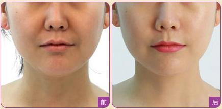 上海眉間紋醫(yī)療整形醫(yī)院強榜前10，選取眉間紋正規(guī)醫(yī)院指南