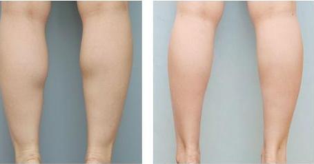 2023年天津韓妃開眼角手術(shù)醫(yī)院排名及性價(jià)比推薦！整形美容行業(yè)的權(quán)威榜單揭曉