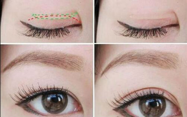 2023連云港眼底紋皺紋整形私立醫(yī)院排名榜單！治療效果很好！