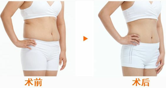 合肥鼻翼鼻頭縮小的醫(yī)療機(jī)構(gòu)，性價(jià)比高的有哪些？合肥2023年前10名醫(yī)療整形醫(yī)院詳盡概況！