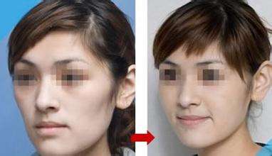 廈門注射膠原蛋白減少川字紋的整形醫(yī)院排名公開！2023廈門膠原蛋白去皺醫(yī)院前10強(qiáng)榜單揭曉！