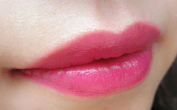 2023上海很受歡迎的射頻吸脂瘦肩部整形醫(yī)院排行榜公布！看看哪些醫(yī)院值得選擇