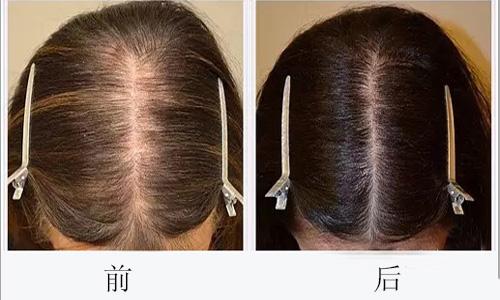 廣州哪些醫(yī)院可靠，專業(yè)進(jìn)行臉部疤痕切除整形美容？2023年十大排名公開(kāi)！