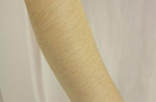 曲靖哪家醫(yī)院的面部注射微雕更專業(yè)？2023年曲靖面部注射微雕醫(yī)療美容TOP10醫(yī)院實力大比拼！