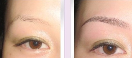 2023年漳州光子嫩膚脫毛正規(guī)醫(yī)療整形醫(yī)院評價TOP10強參考-誰的性價比比較高？