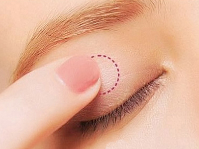 鄭州眼角紋祛除美容醫(yī)院哪家口碑好？2023年TOP10排行出爐