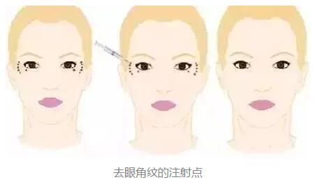 2023年北京鼻端缺損整形美容醫(yī)院前十強(qiáng)排名揭曉！知名度爆棚的醫(yī)療機(jī)構(gòu)盤點(diǎn)！