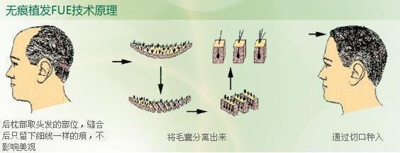 2023青島眼袋修復(fù)手術(shù)排名前10的信譽(yù)醫(yī)院！