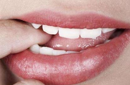 2023西安頸部皺紋消除手術(shù)醫(yī)院排行榜TOP10公布，哪些醫(yī)院備受推崇？