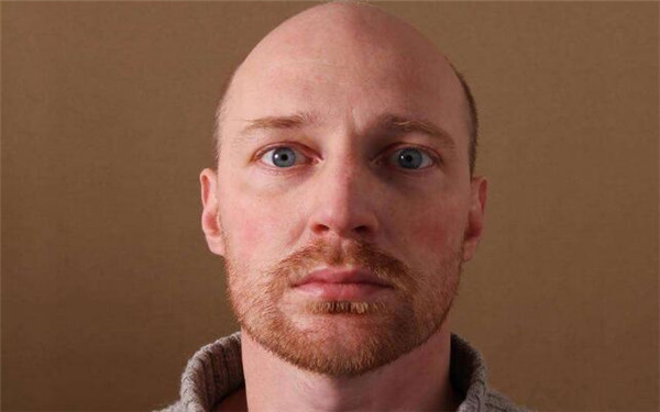 2023年舟山韓式開眼角手術(shù)醫(yī)院推薦，口碑爆棚的前10家醫(yī)院盤點(diǎn)！