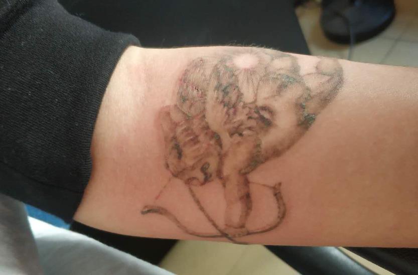 宿遷洗紋身醫(yī)院榮獲六強名單，口碑彰顯實力！