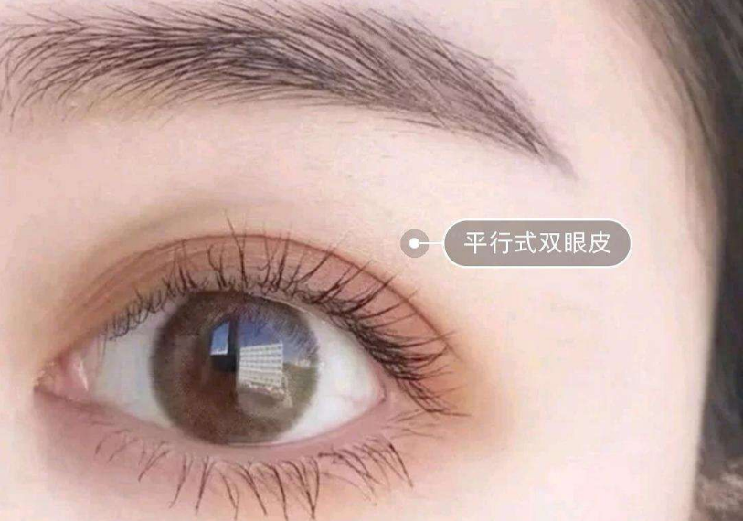 鄭州最受推崇的雙眼皮整形專家推薦榜單露臉！多位實力經(jīng)驗高手霸占榜首！