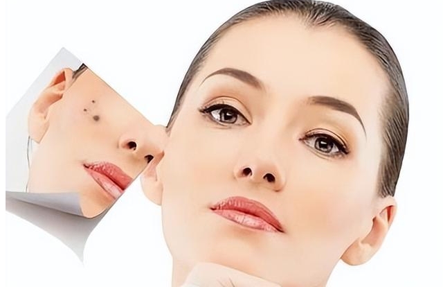 2023昆明哪家整形美容醫(yī)院面部去痣口碑比較好？評(píng)分10強(qiáng)你知道嗎？