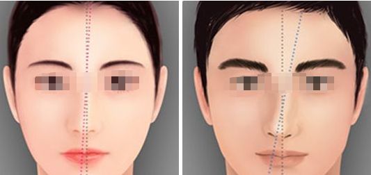 北京射頻溶脂瘦腹部醫(yī)院TOP 5 權(quán)威排名公布！