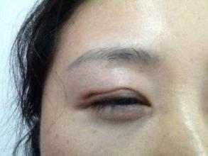 南昌大小臉改善醫(yī)院PK：公立與私立哪家強？(2025版)