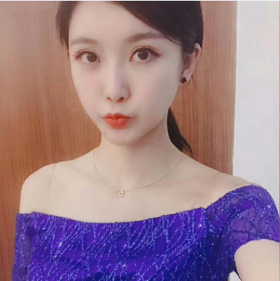 眼綜合術(shù)前VS術(shù)后，自然大眼睛值得稱贊！