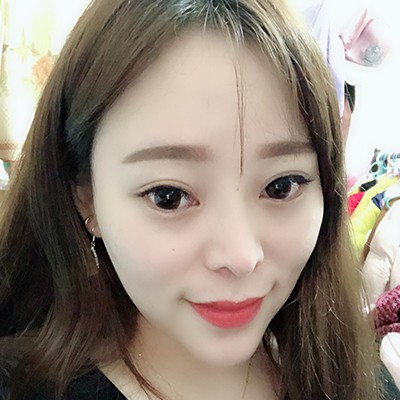 術(shù)前矮低平，術(shù)后高挺翹~肋軟骨隆鼻效果好的不得了！