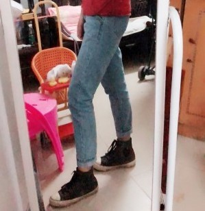 胖腿女孩兒福利分享：吸脂瘦大腿的蛻變，效果值得點(diǎn)贊！