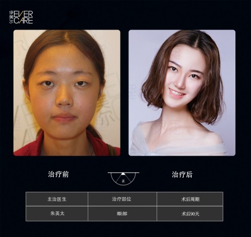 阿爾法9°美眼，打開視界，美無止境