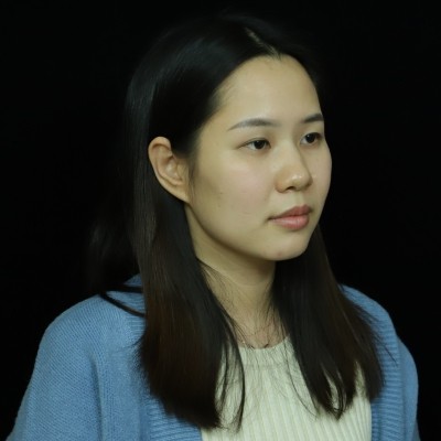 記錄我在廣州韓妃整形美容醫(yī)院眼綜合的手術(shù)經(jīng)歷，還有前后對比照片~