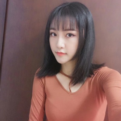 眼綜合術(shù)前VS術(shù)后，自然大眼睛值得稱贊！