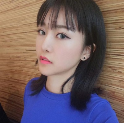 眼綜合術(shù)前VS術(shù)后，自然大眼睛值得稱贊！