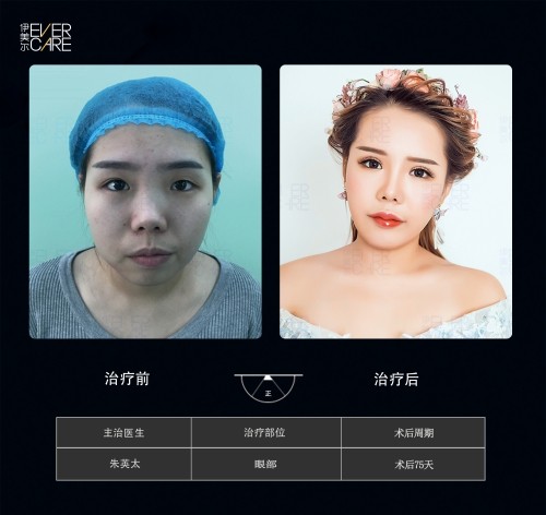 阿爾法9°美眼，打開視界，美無止境