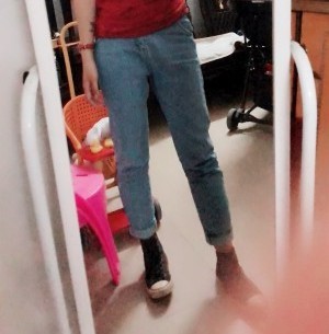 胖腿女孩兒福利分享：吸脂瘦大腿的蛻變，效果值得點(diǎn)贊！