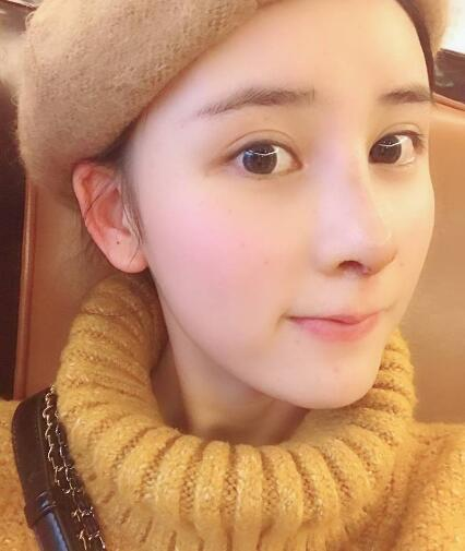 北京哪家隆鼻好？花一萬鼻子做成這樣值不值