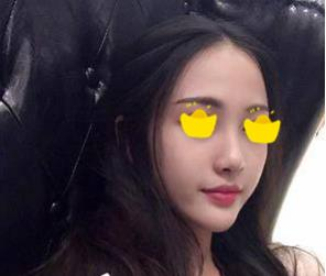 塌鼻子小妹在深圳鵬愛做隆鼻手術(shù)，三個(gè)月后竟然是這樣的