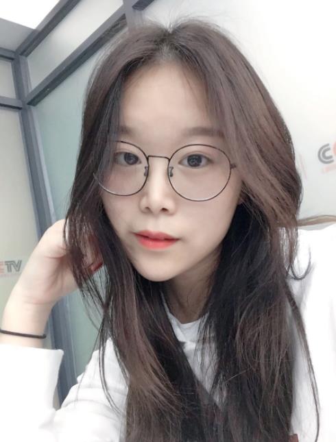 石家莊諾萬整形肋軟骨隆鼻案例術(shù)后兩個(gè)月效果