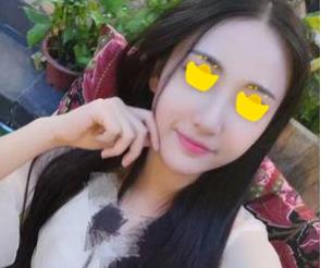 深圳鵬愛(ài)做隆鼻手術(shù)兩個(gè)月效果