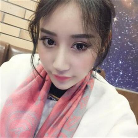 雙眼皮失敗丑的不敢見人，昆明麗都整形雙眼皮修復(fù)案例分享