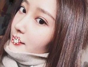 北京彤美耳軟骨隆鼻案例分享術(shù)后一個月效果