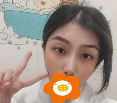 救命，周杰群做的耳軟骨隆鼻恢復(fù)后鼻背線條也太好看了吧