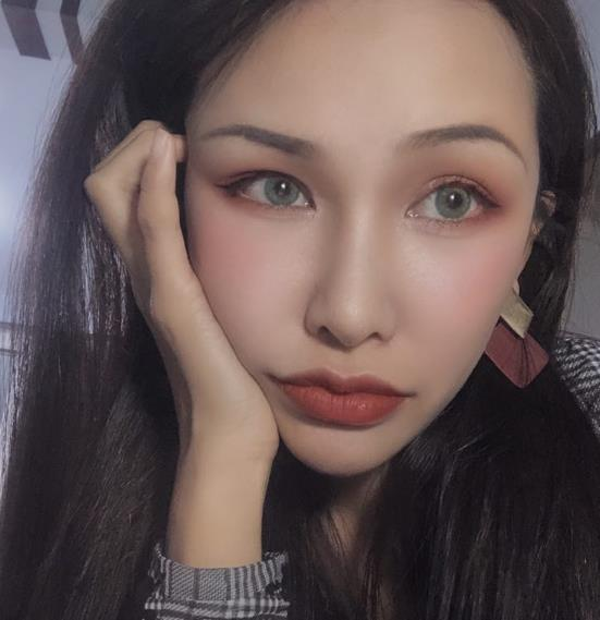 長(zhǎng)春中研整形黃帝云鼻頭縮小術(shù)后三個(gè)月效果反饋圖