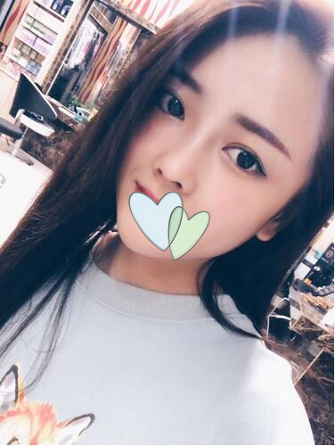 廈門海峽整形鼻綜合案例分享，這鼻子可以滑滑梯了