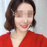 杭州國(guó)雅口腔隱形矯正案例分享，有這么好看的牙就要多笑笑