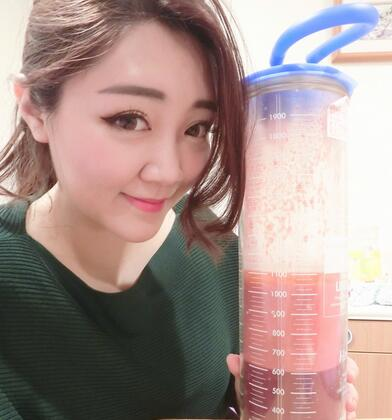 揭陽美萊整形手臂吸脂案例分享，輕松告別拜拜肉