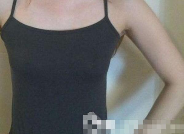 吉安第二醫(yī)院妙桃假體隆胸案例，我一女的都賊喜歡