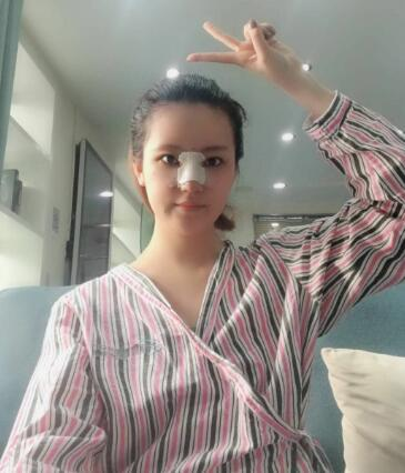 北京葉子整形肋軟骨隆鼻案例反饋，這鼻子是真實(shí)存在的嗎